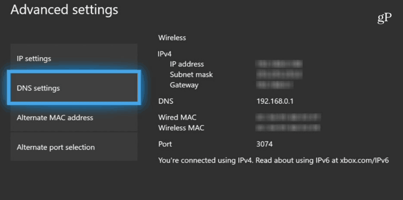 انتخاب تنظیمات DNS در Xbox برای تغییر دی ان اس